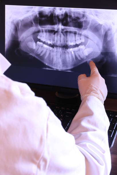 Best Emergency Treatment for Dental Infections or Abscesses in Naples, FL