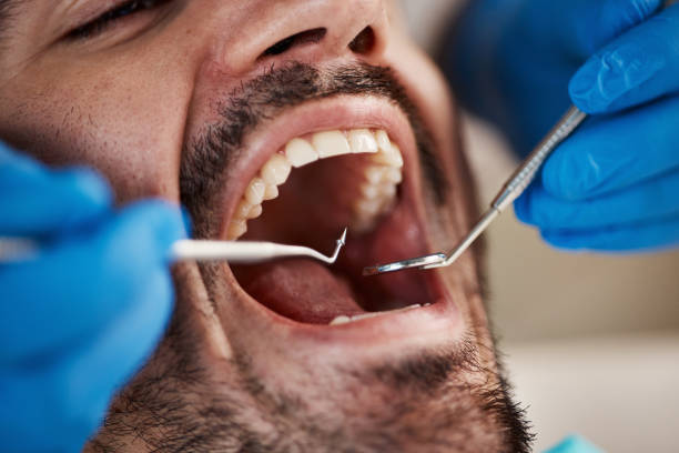 Best Weekend Emergency Dentist in Naples, FL