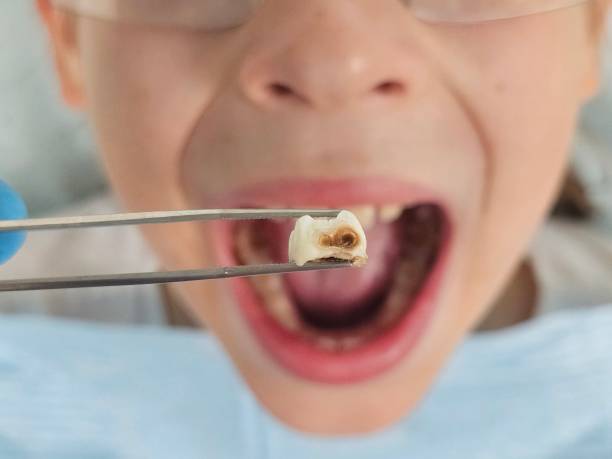 Best Pediatric Emergency Dentist in Naples, FL