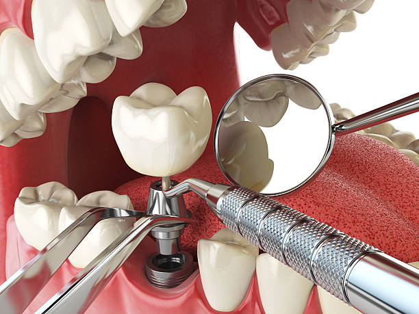 Best Cosmetic Emergency Dentistry in Naples, FL